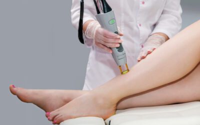 SEO Keywords for Laser Hair Removal Services